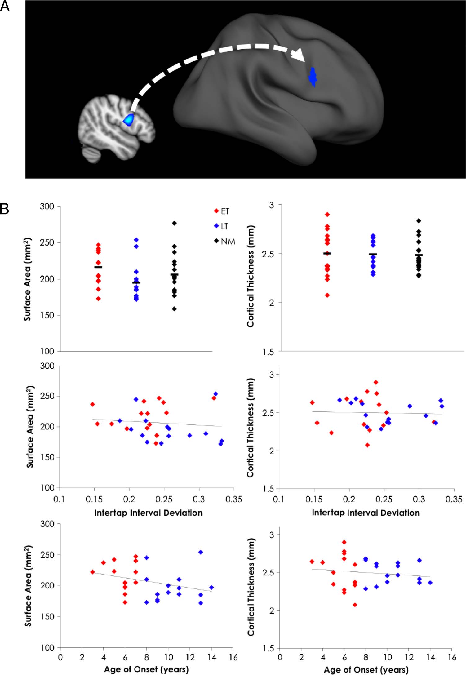 Early Musical Training Is Linked to Gray Matter Structure image