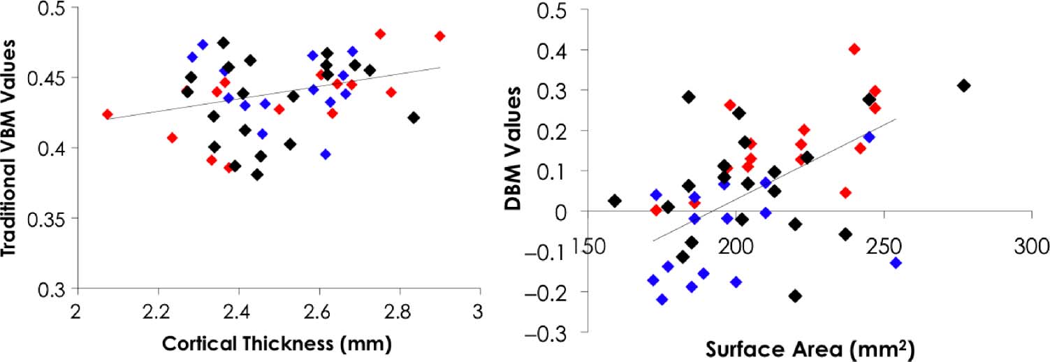 Early Musical Training Is Linked to Gray Matter Structure image