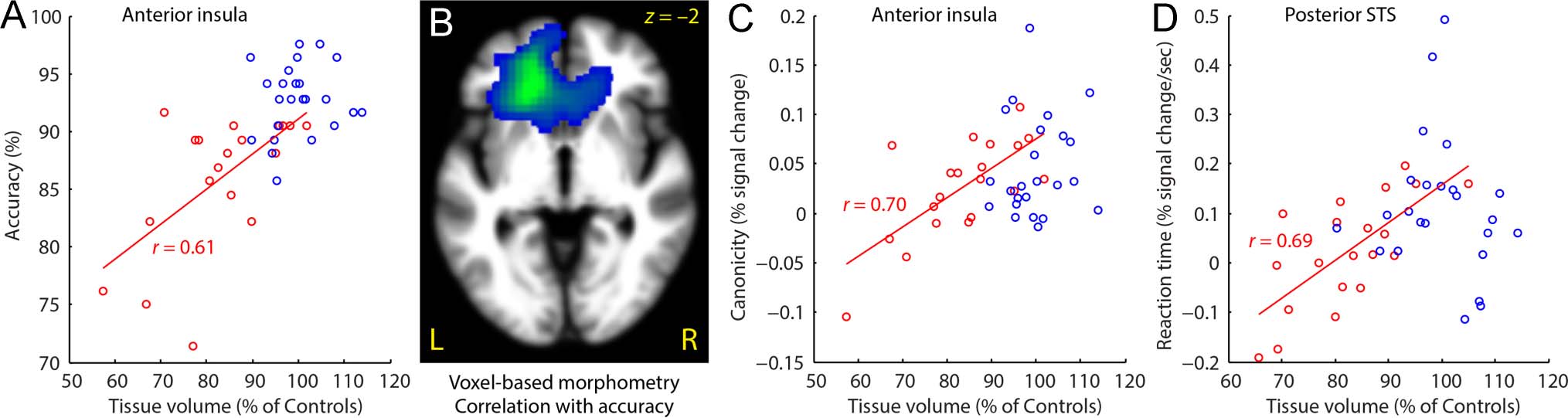 What Role Does the Anterior Temporal Lobe Play image