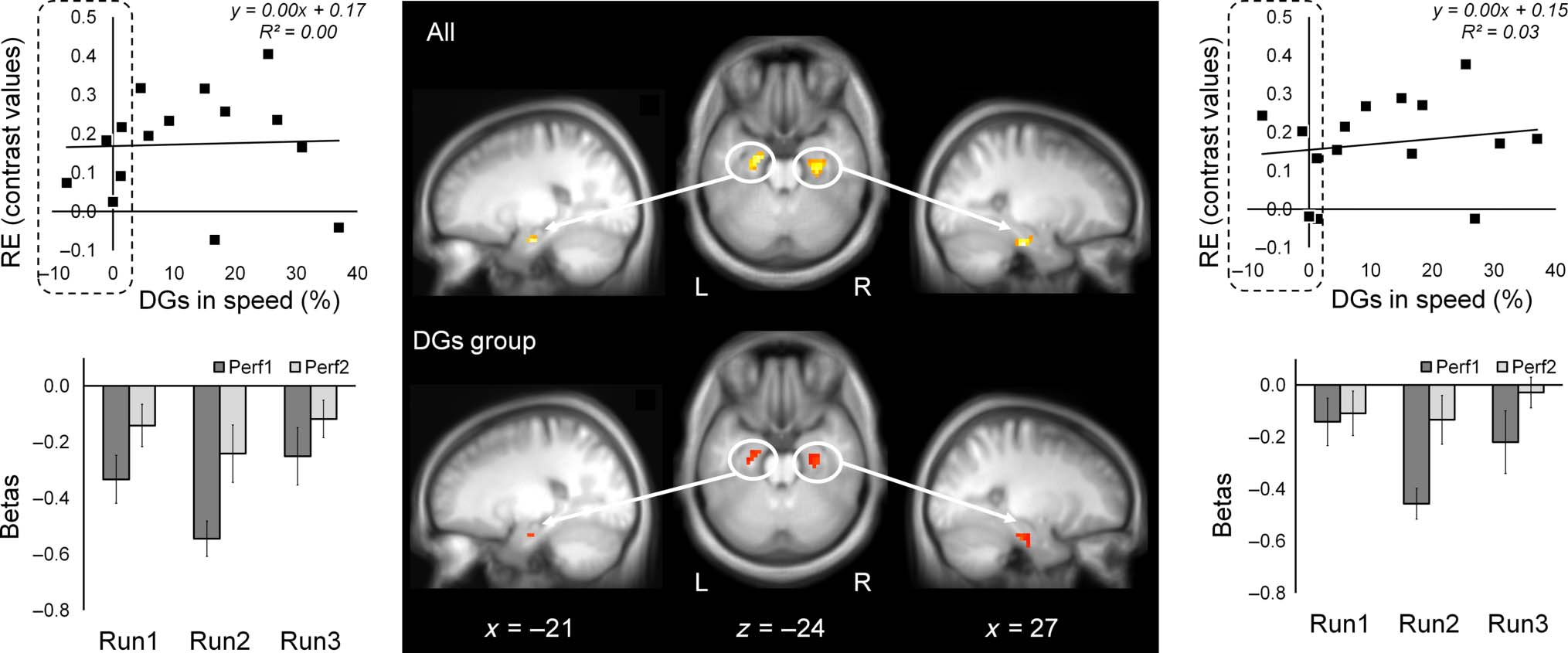 Done That: Short-term Repetition Related Modulations of image