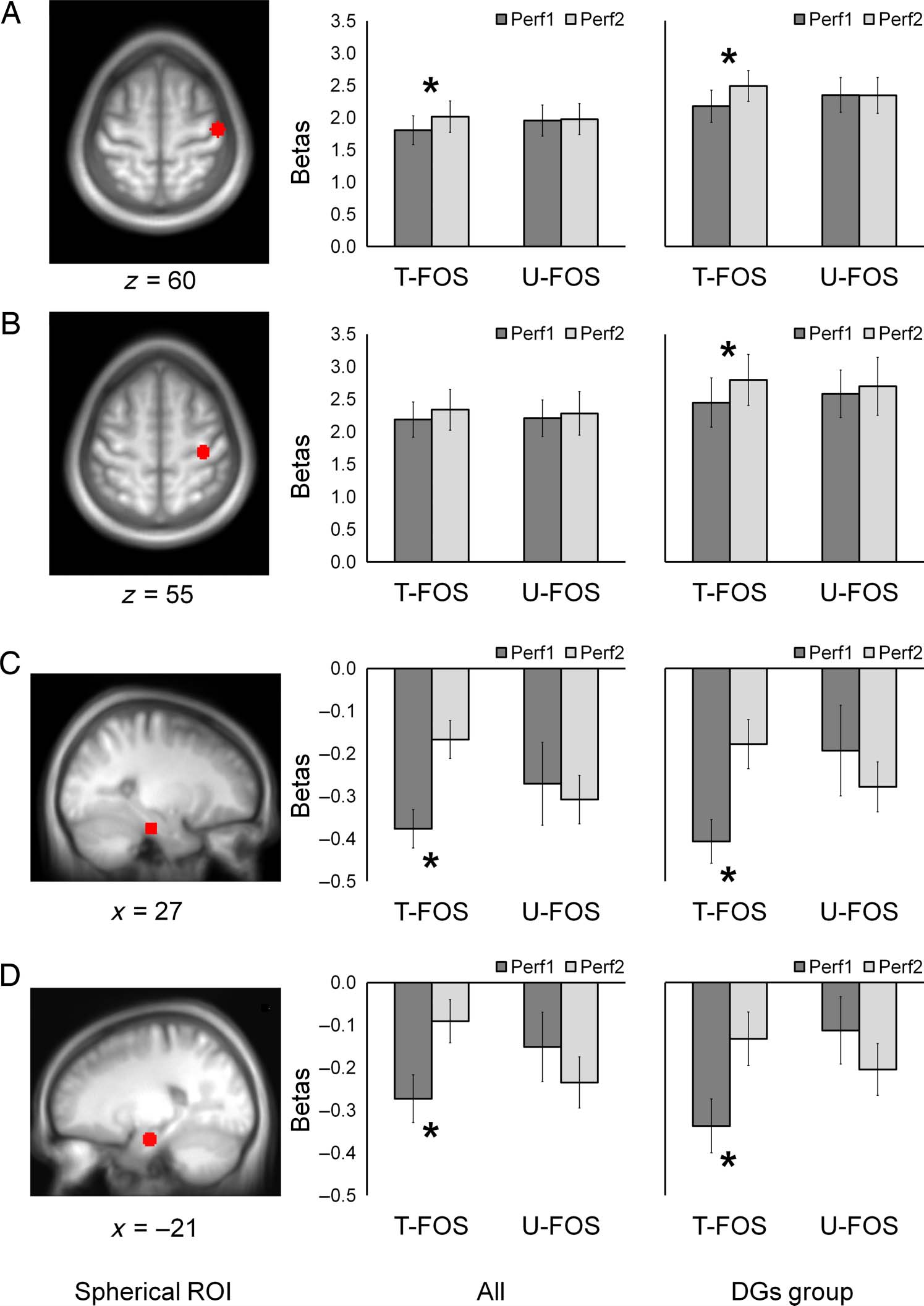 Done That: Short-term Repetition Related Modulations of image