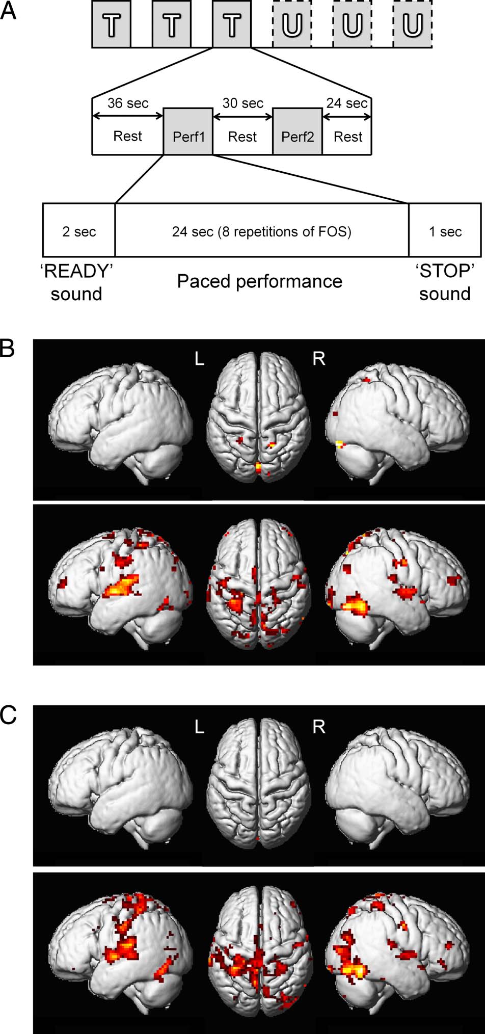 Done That: Short-term Repetition Related Modulations of image