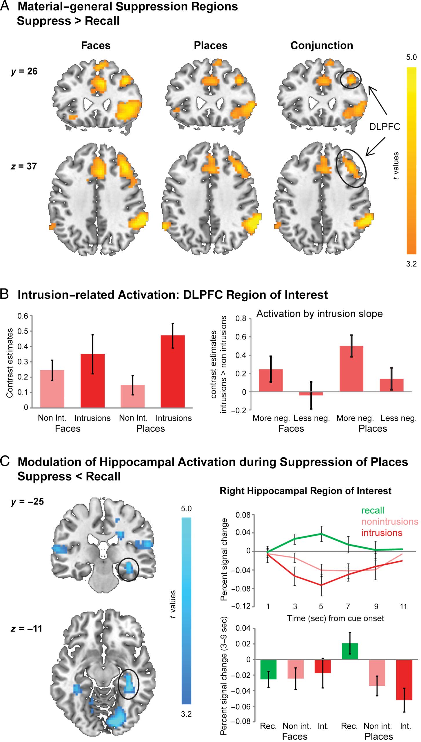 Adaptive Top–Down Suppression of Hippocampal image