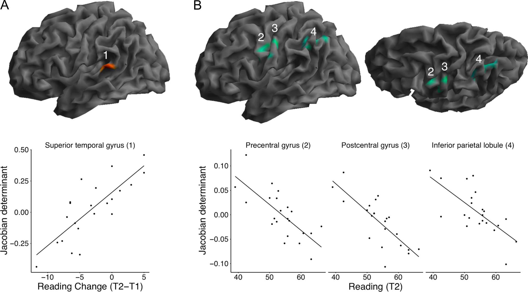 The Association between Gray Matter Volume and image