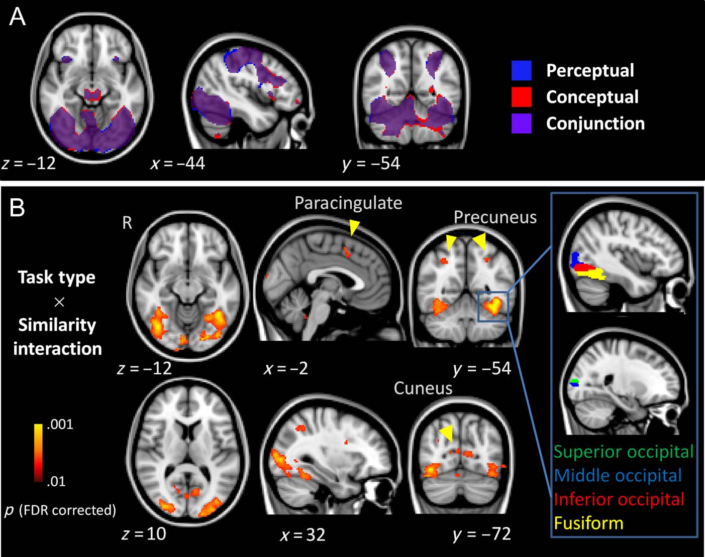 Structural Similarity Exerts Opposing Effects on Perceptual image