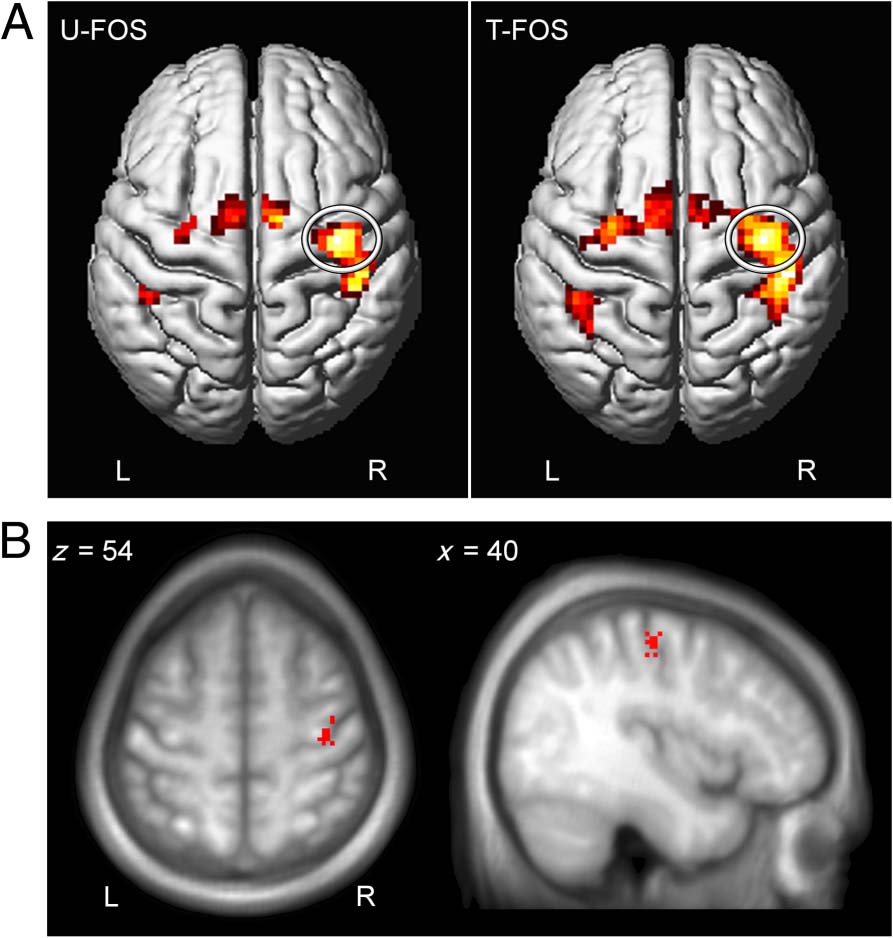 Patterns of Modulation in the Activity and Connectivity image