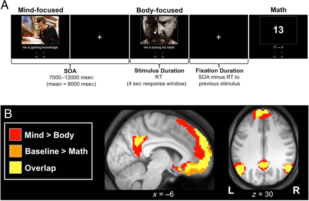 The Default Mode of Human Brain Function Primes the image