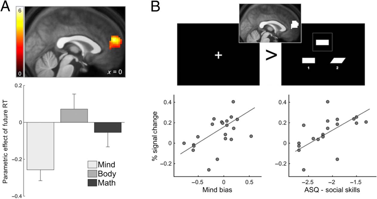 The Default Mode of Human Brain Function Primes the image