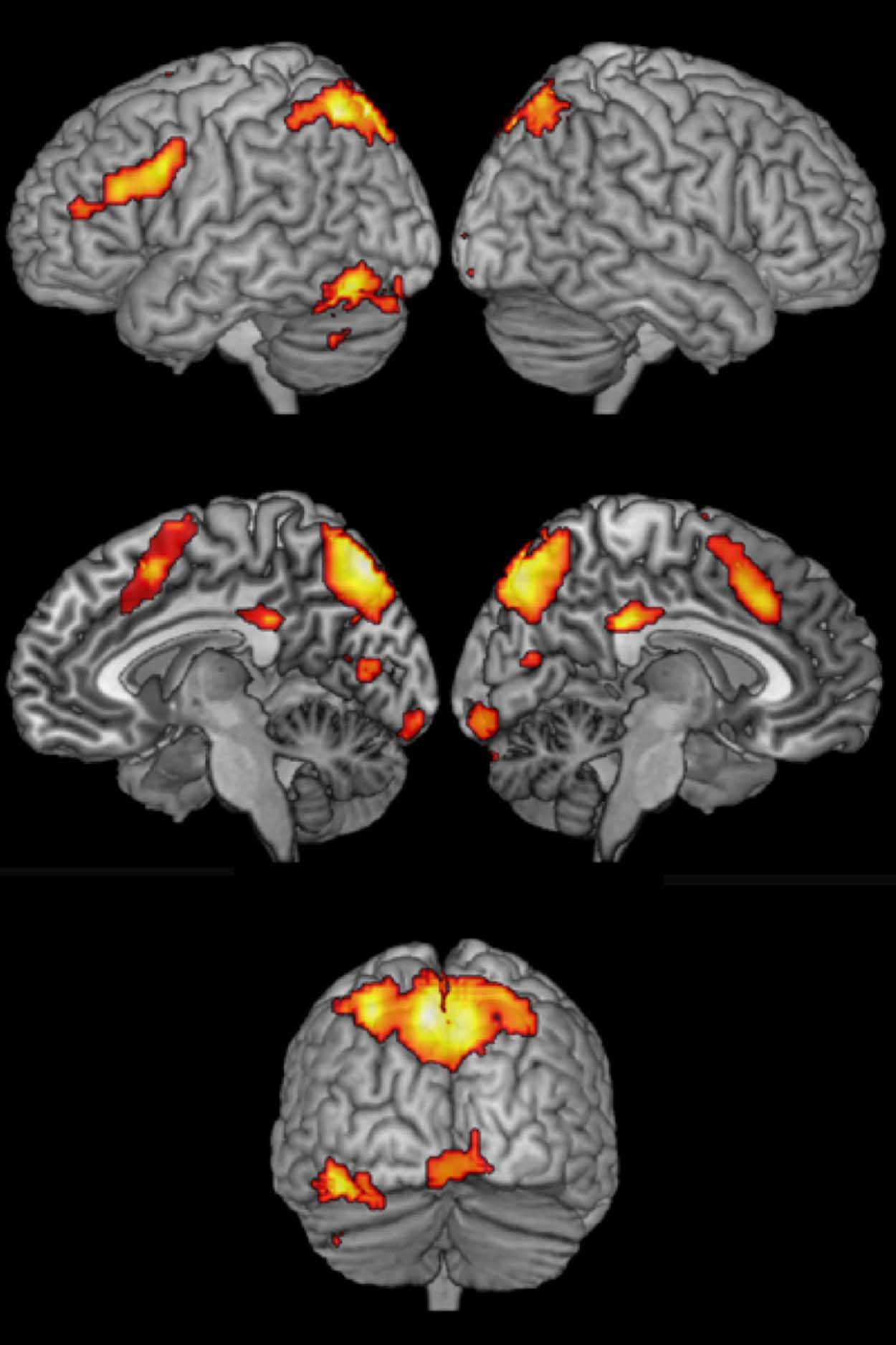 Brain Circuit for Cognitive Control Is Shared image