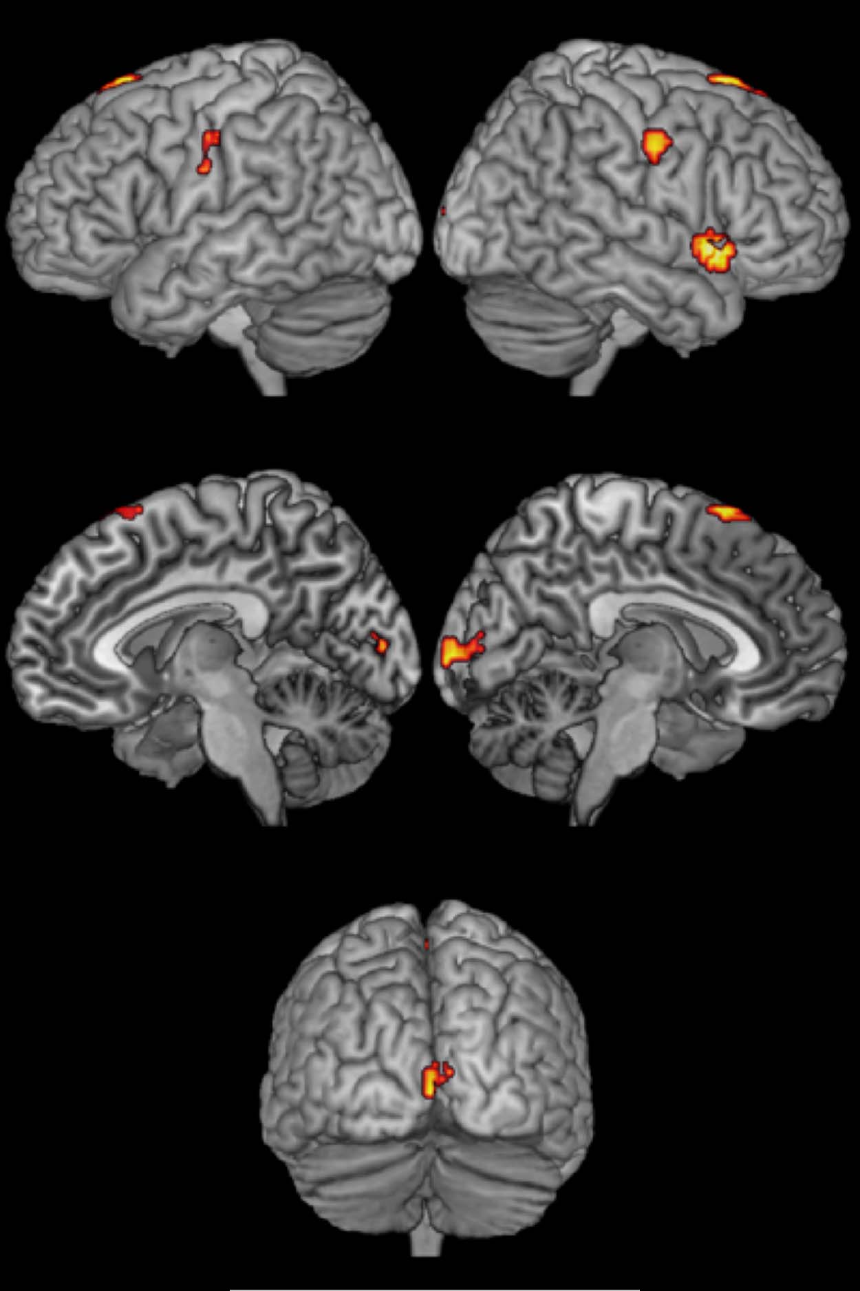 Brain Circuit for Cognitive Control Is Shared image