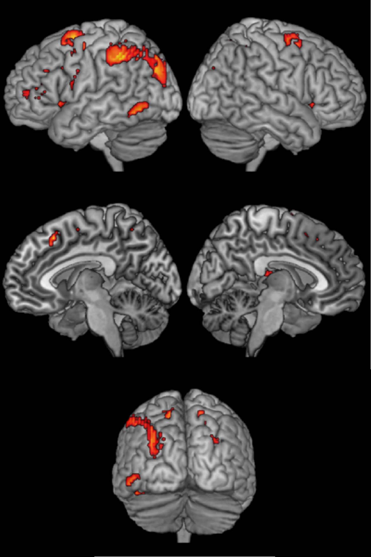 Brain Circuit for Cognitive Control Is Shared image