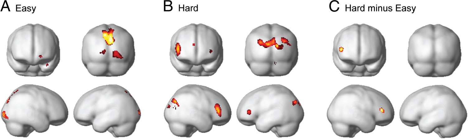 Flexible Coding of Task Rules in Frontoparietal Cortex: image