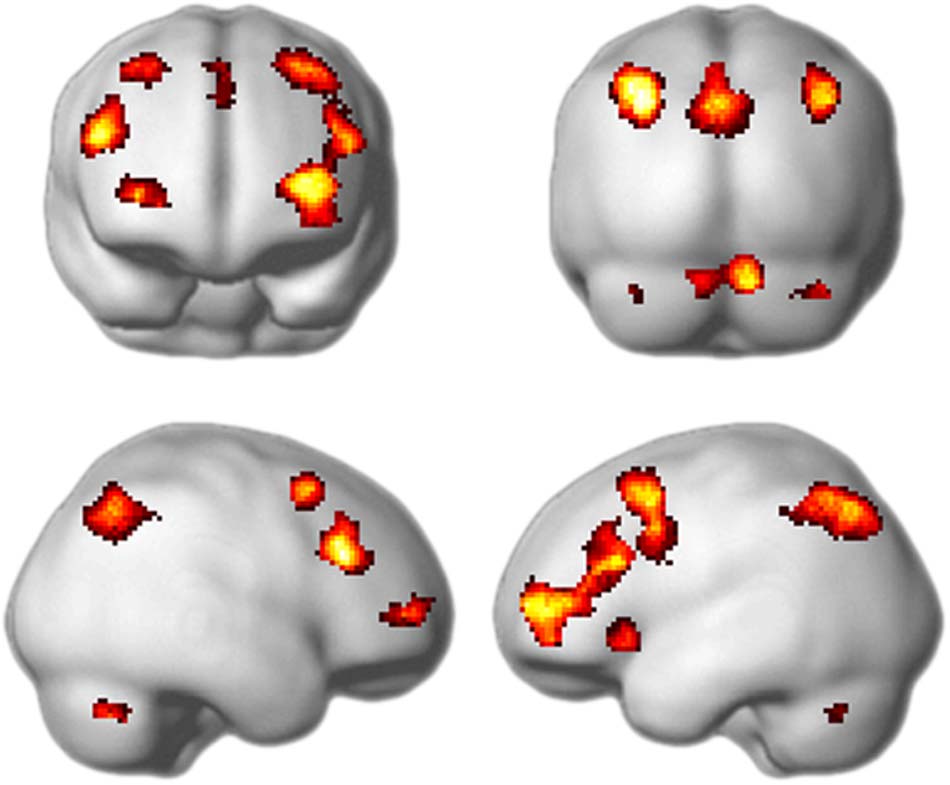 Flexible Coding of Task Rules in Frontoparietal Cortex: image