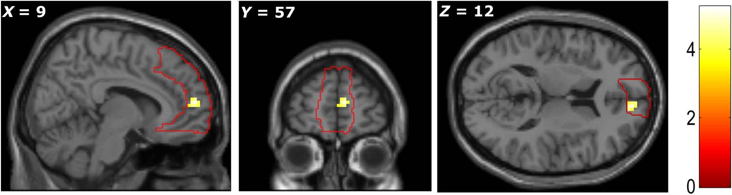 Medial Prefrontal Cortex: Adding Value image