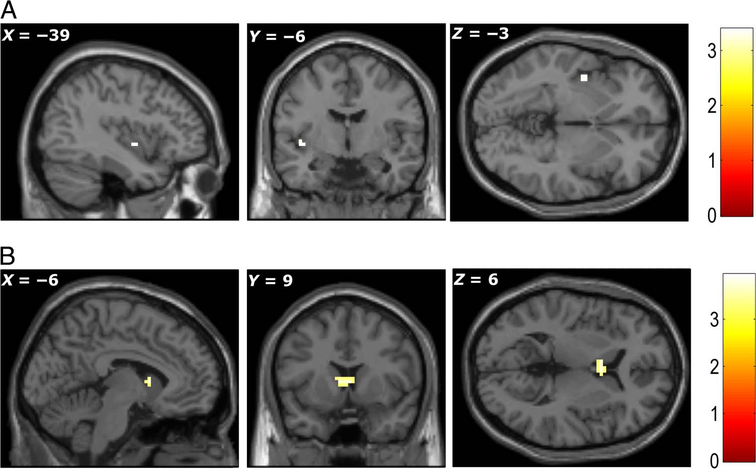 Medial Prefrontal Cortex: Adding Value image