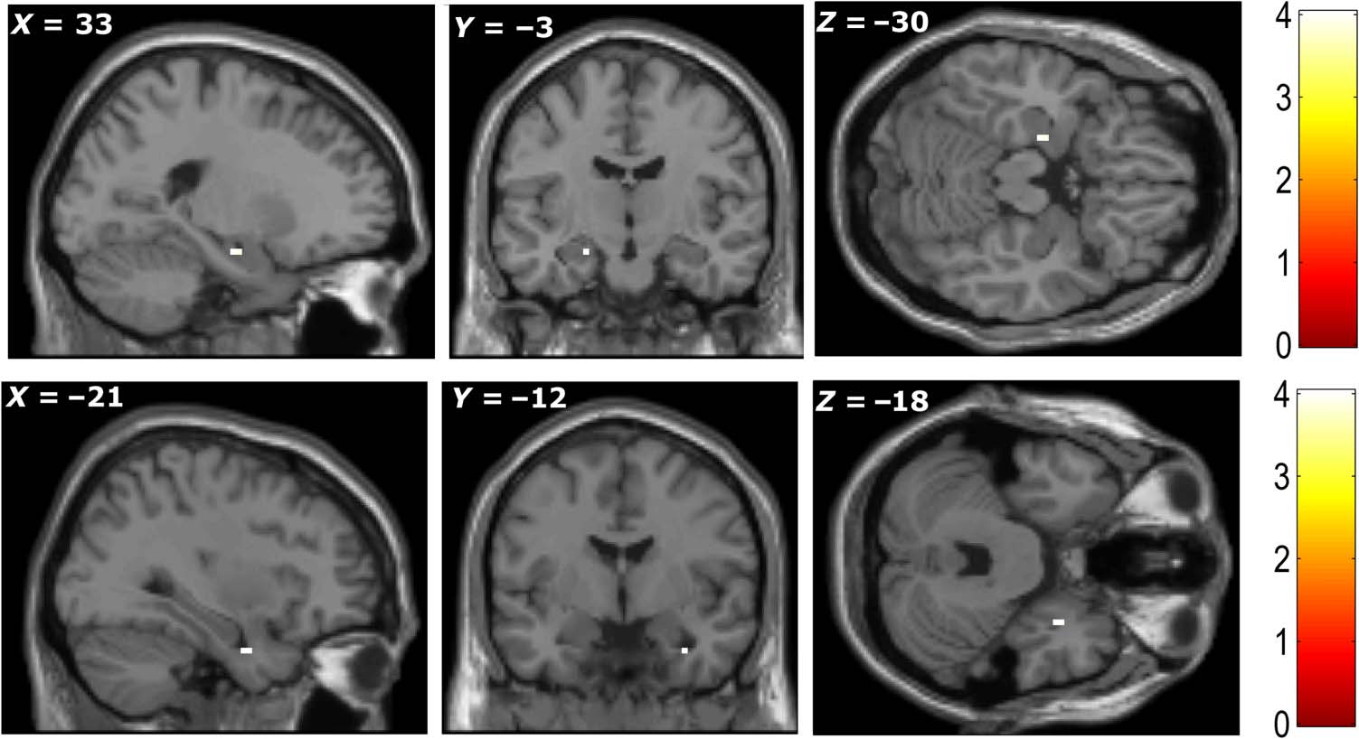 Medial Prefrontal Cortex: Adding Value image