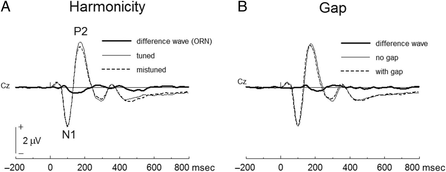 Attentional Capacity Limits Gap Detection image