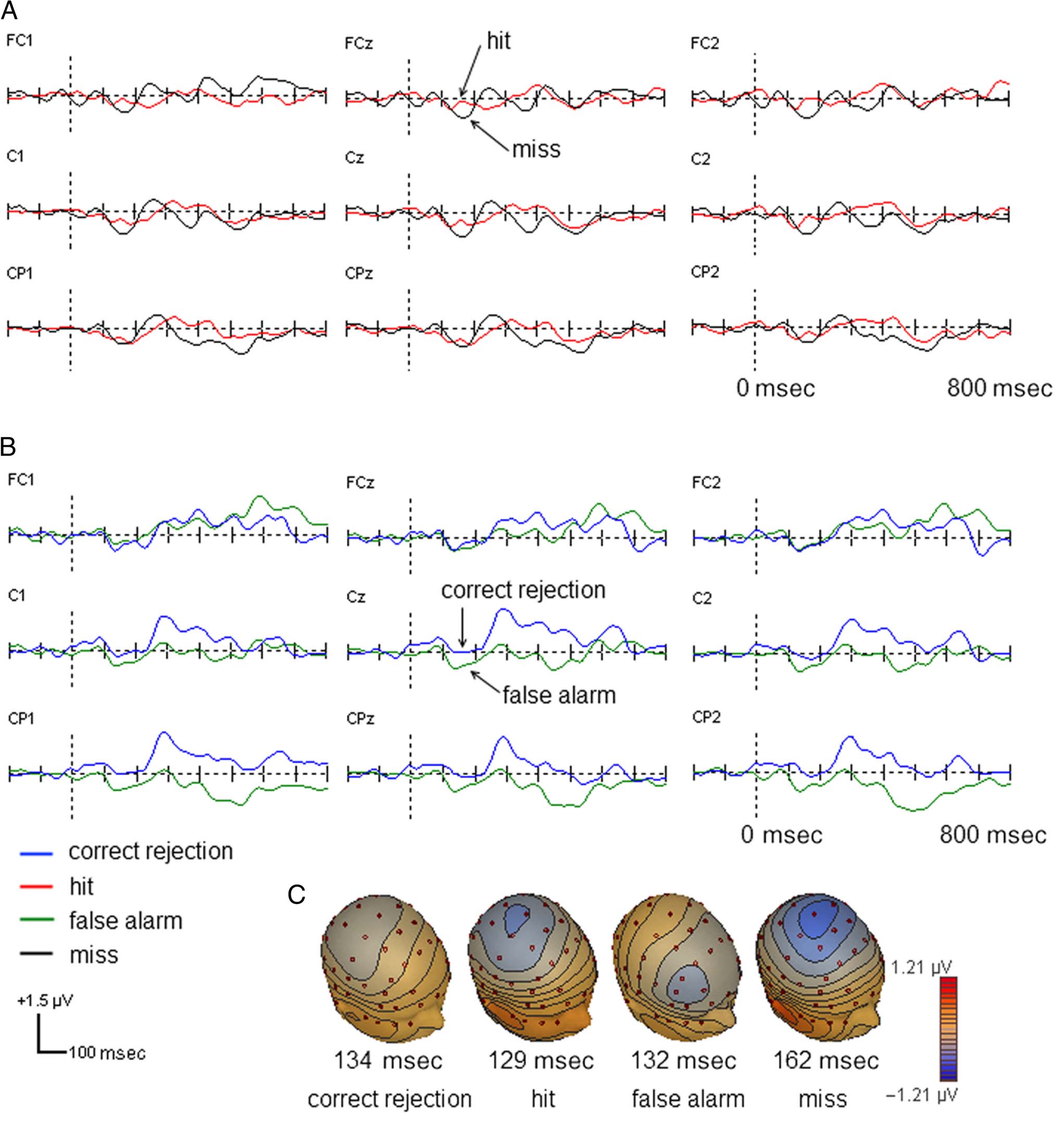 Attentional Capacity Limits Gap Detection image