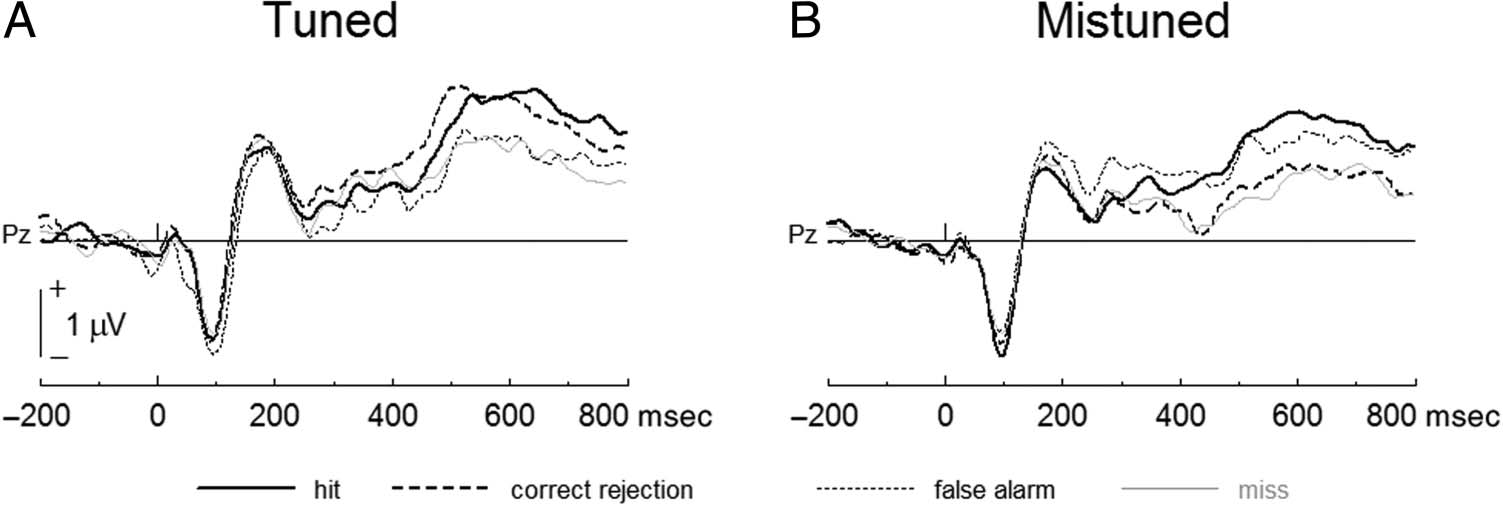 Attentional Capacity Limits Gap Detection image