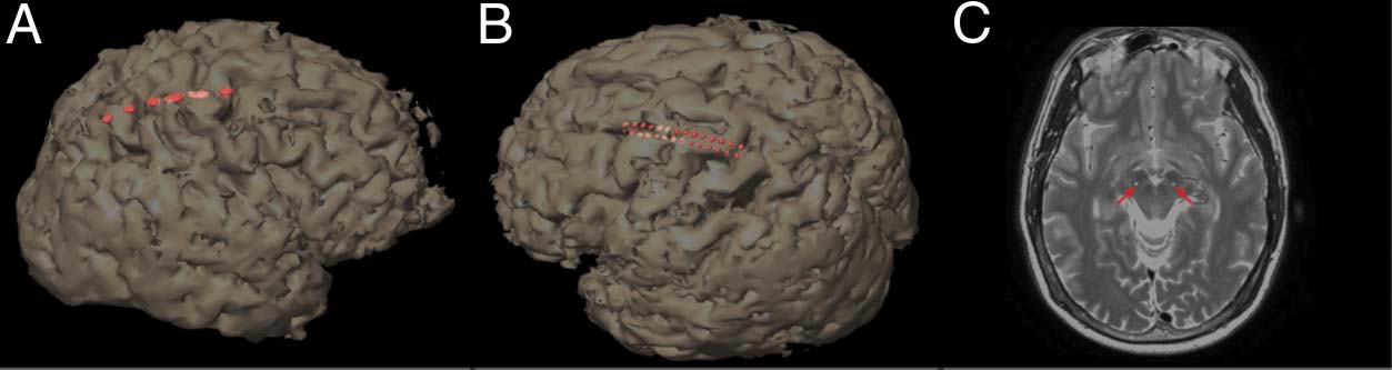 Motor System Interactions in the Beta Band Decrease image