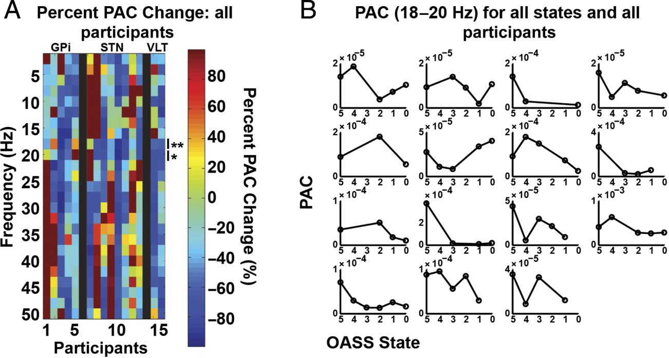 Motor System Interactions in the Beta Band Decrease image