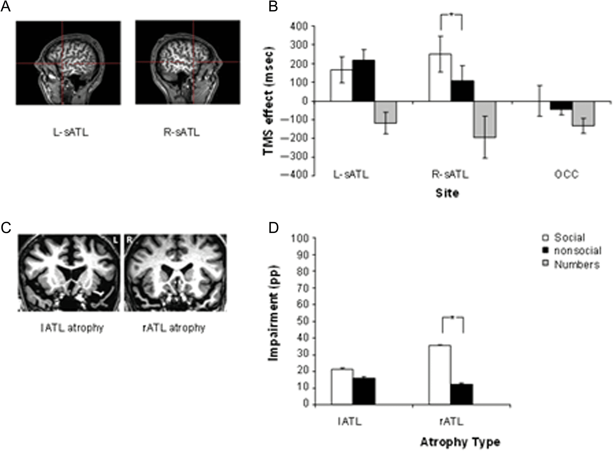 Hemispheric Specialization within the Superior Anterior image