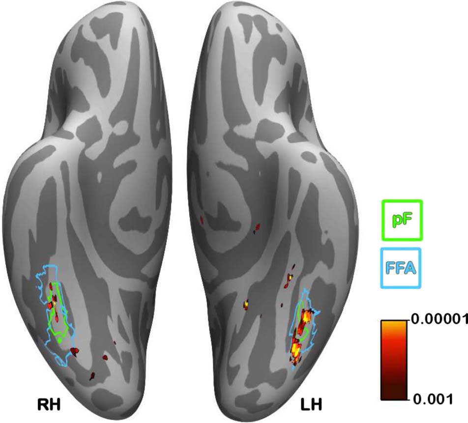 Multivoxel Object Representations in Adult Human Visual image