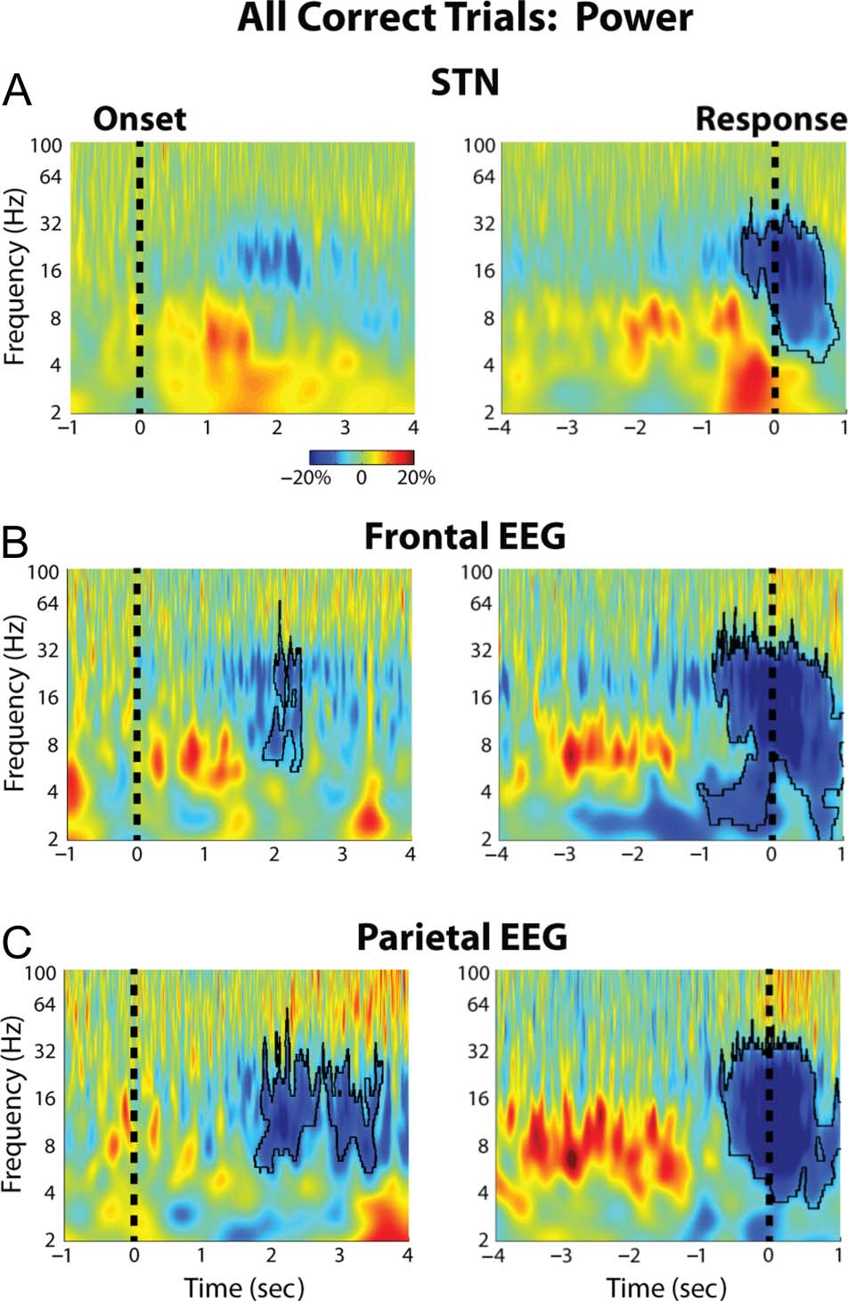 Decisions Made with Less Evidence Involve Higher Levels image