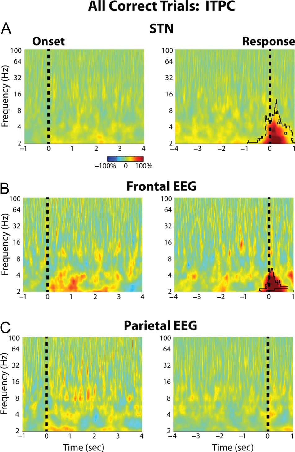 Decisions Made with Less Evidence Involve Higher Levels image