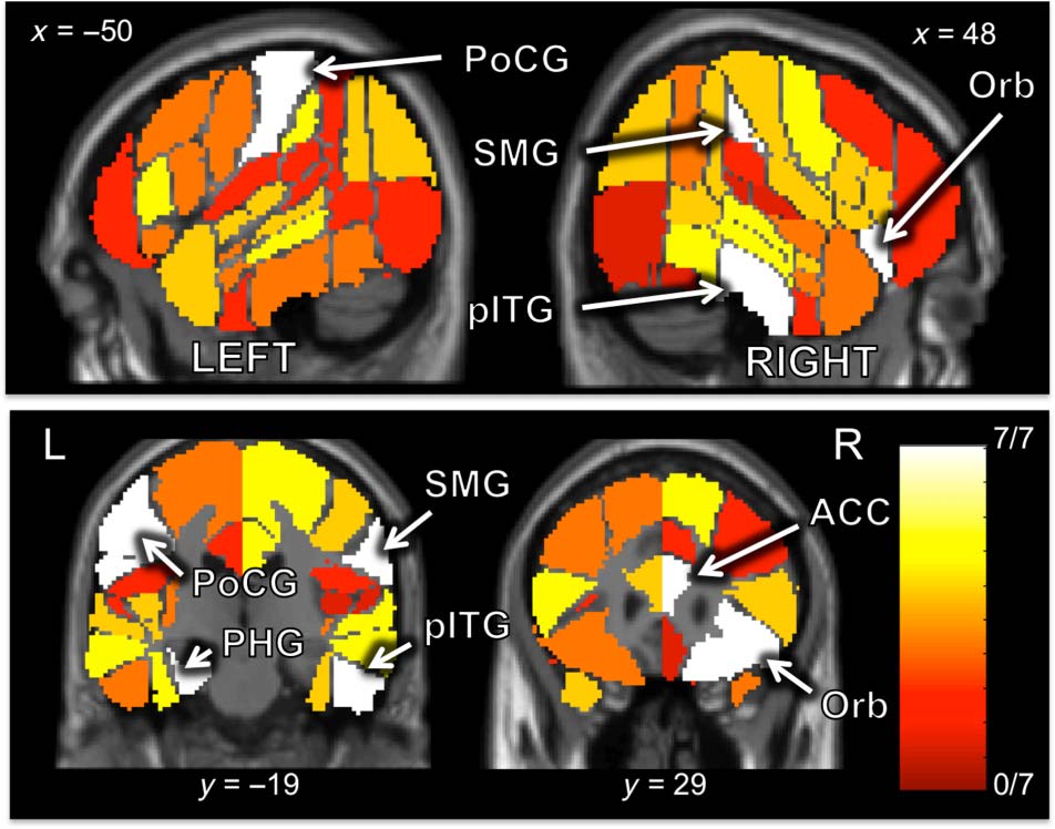 Semantic Structural Alignment of Neural Representational image