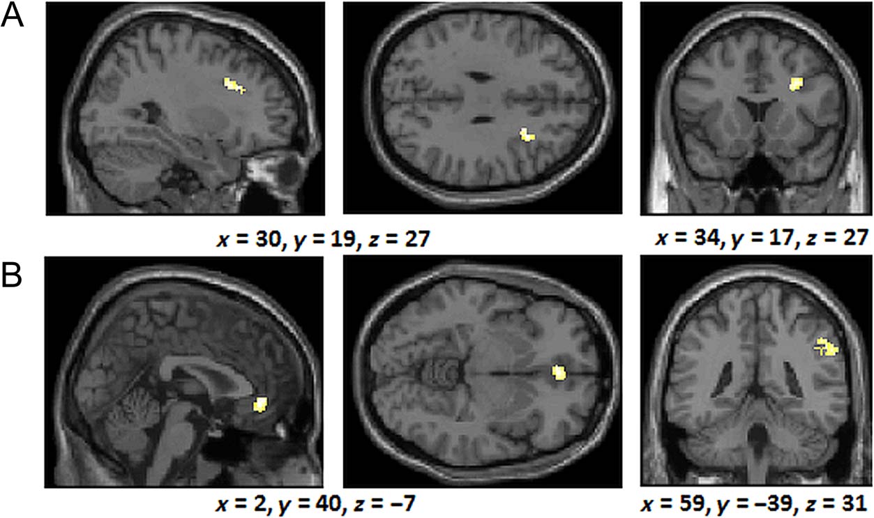 The Neural Correlates of Similarity- and image