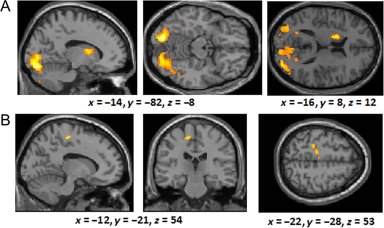 The Neural Correlates of Similarity- and image