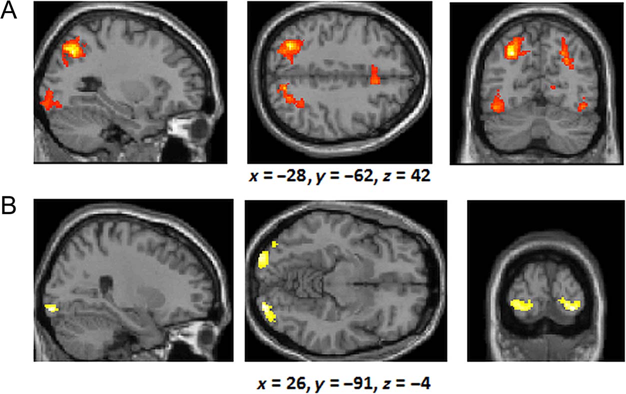 The Neural Correlates of Similarity- and image