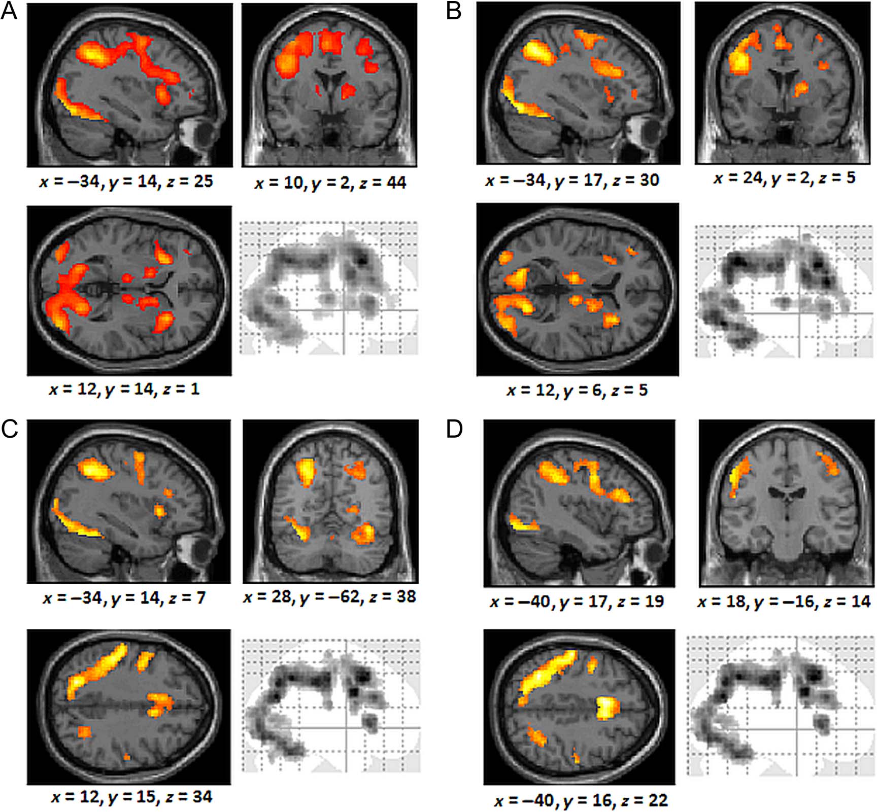 The Neural Correlates of Similarity- and image