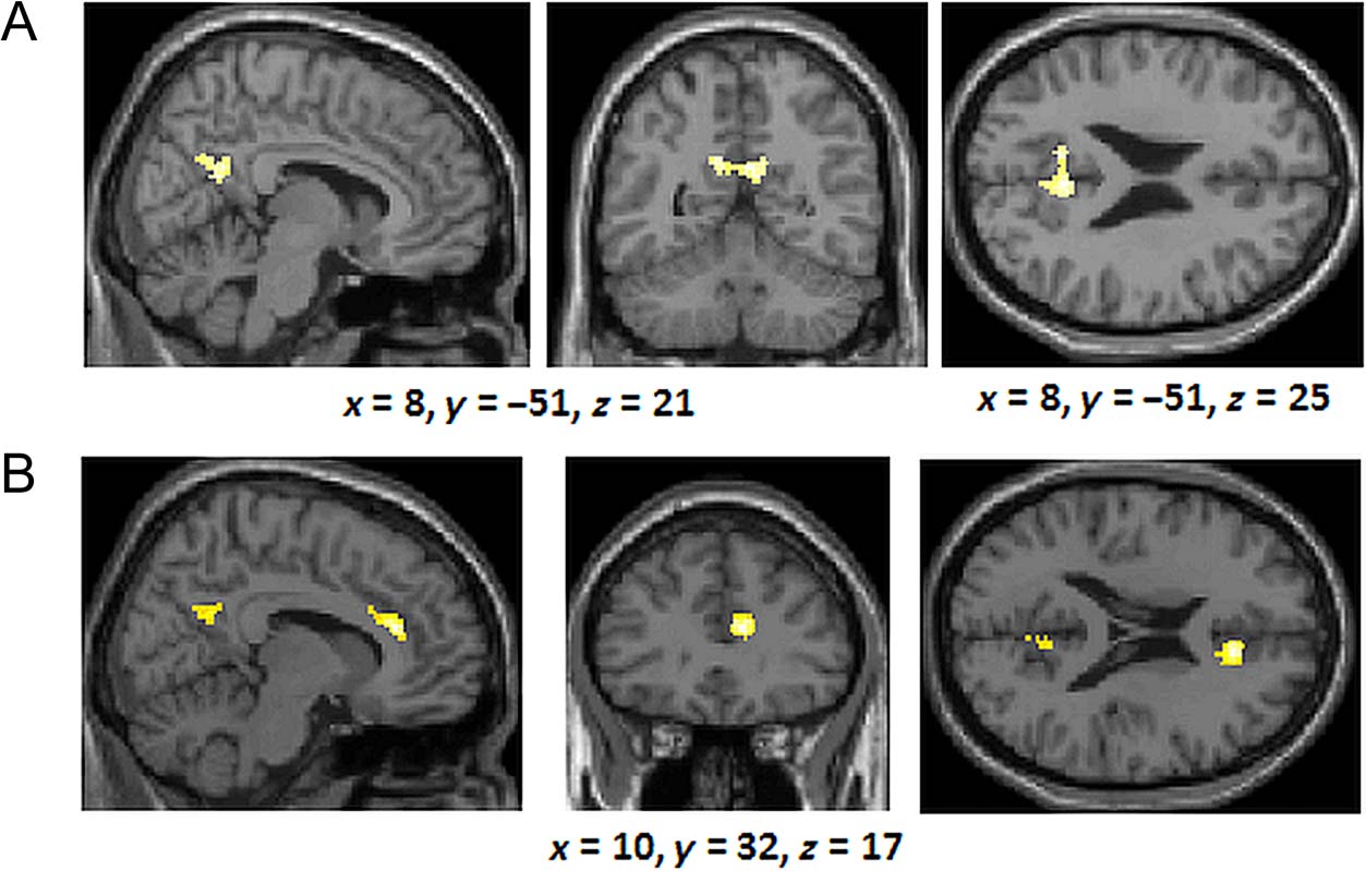 The Neural Correlates of Similarity- and image