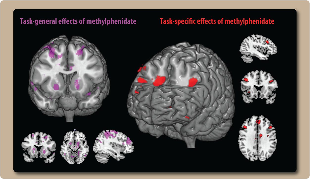 The Neurocognitive Cost of Enhancing Cognition with image