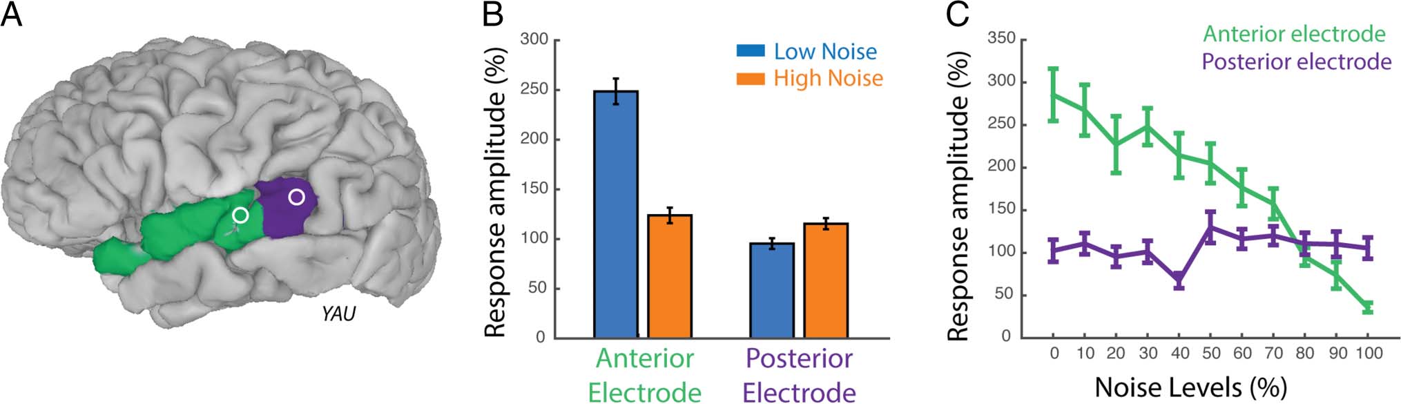 A Double Dissociation between Anterior and Posterior image