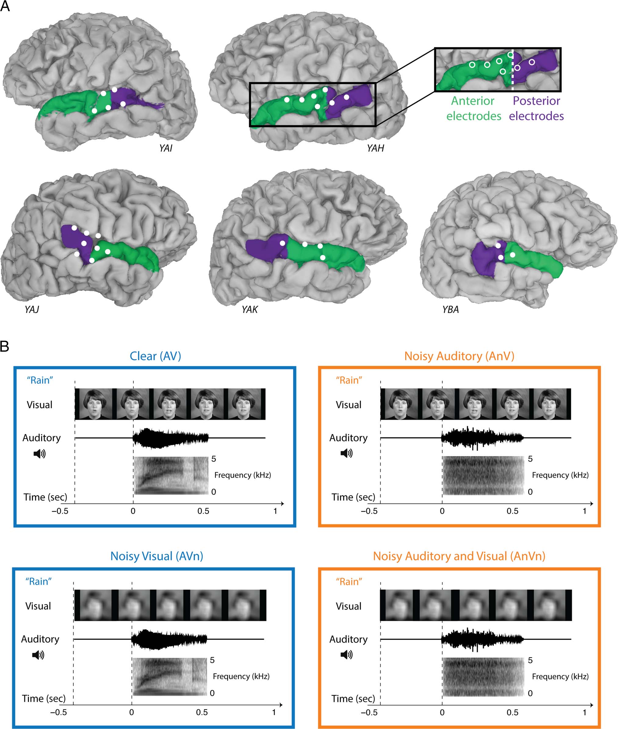 A Double Dissociation between Anterior and Posterior image