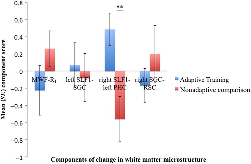 Dynamics of White Matter Plasticity Underlying Working image