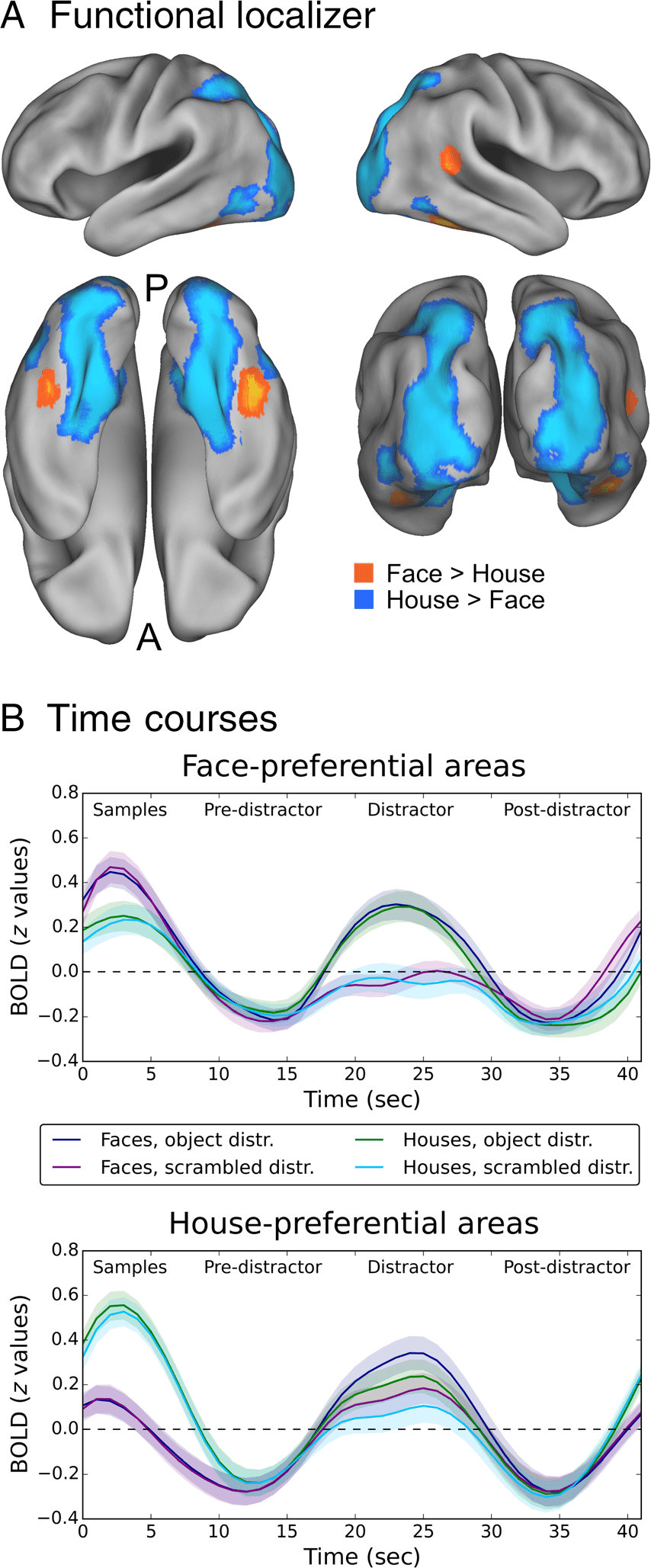 Distractor-resistant Short-Term Memory Is Supported by image