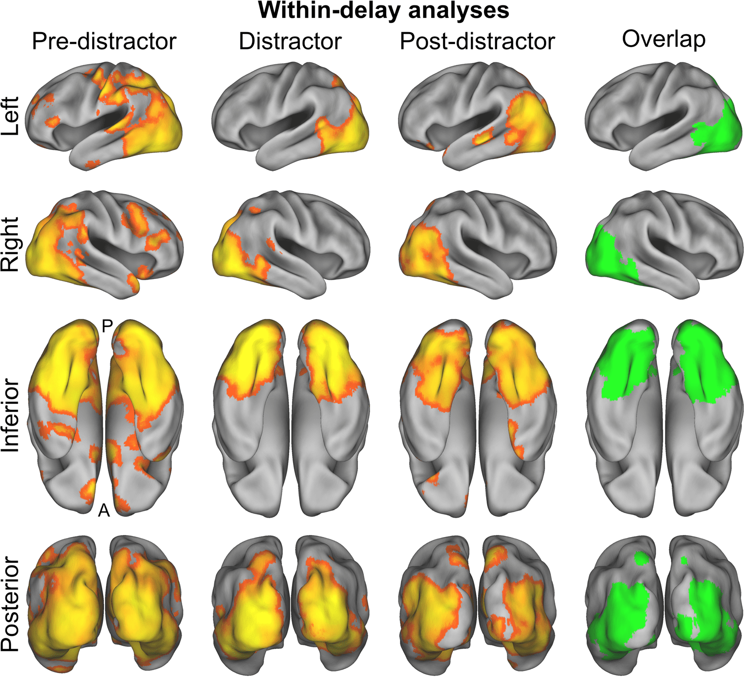 Distractor-resistant Short-Term Memory Is Supported by image