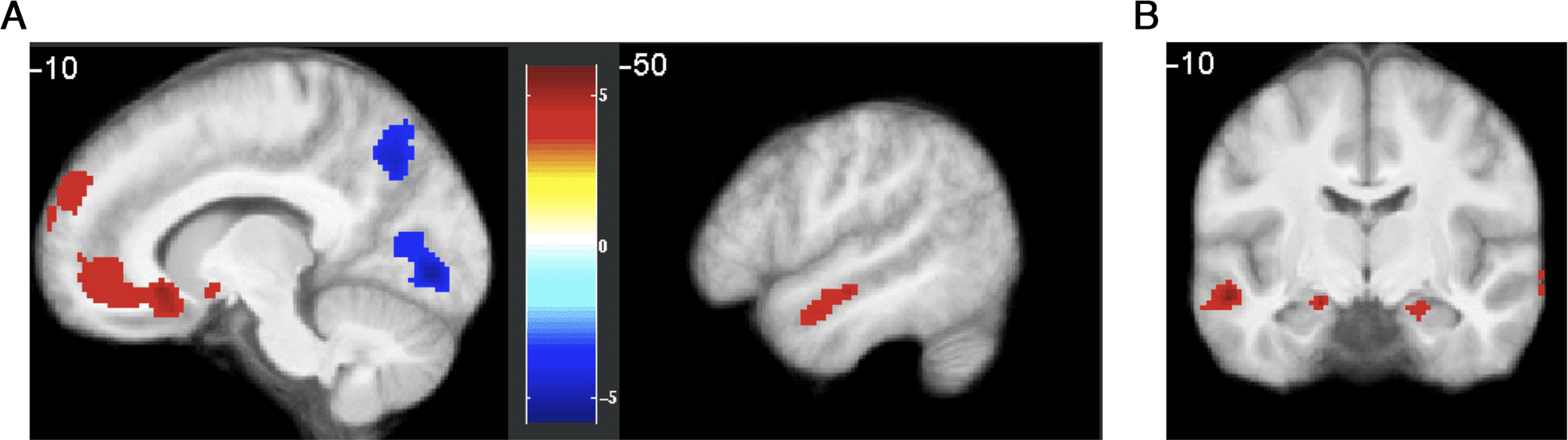 Imaginative Reinforcement Learning: Computational image