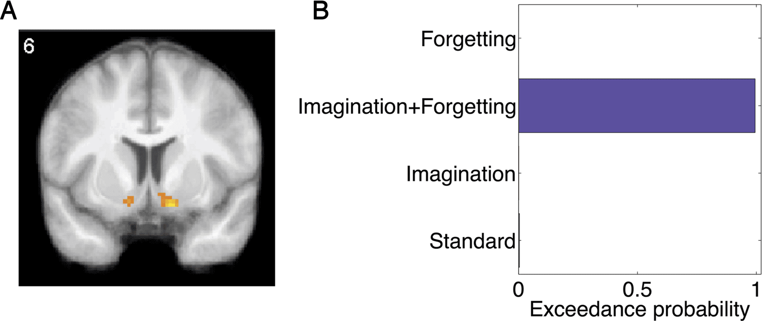 Imaginative Reinforcement Learning: Computational image