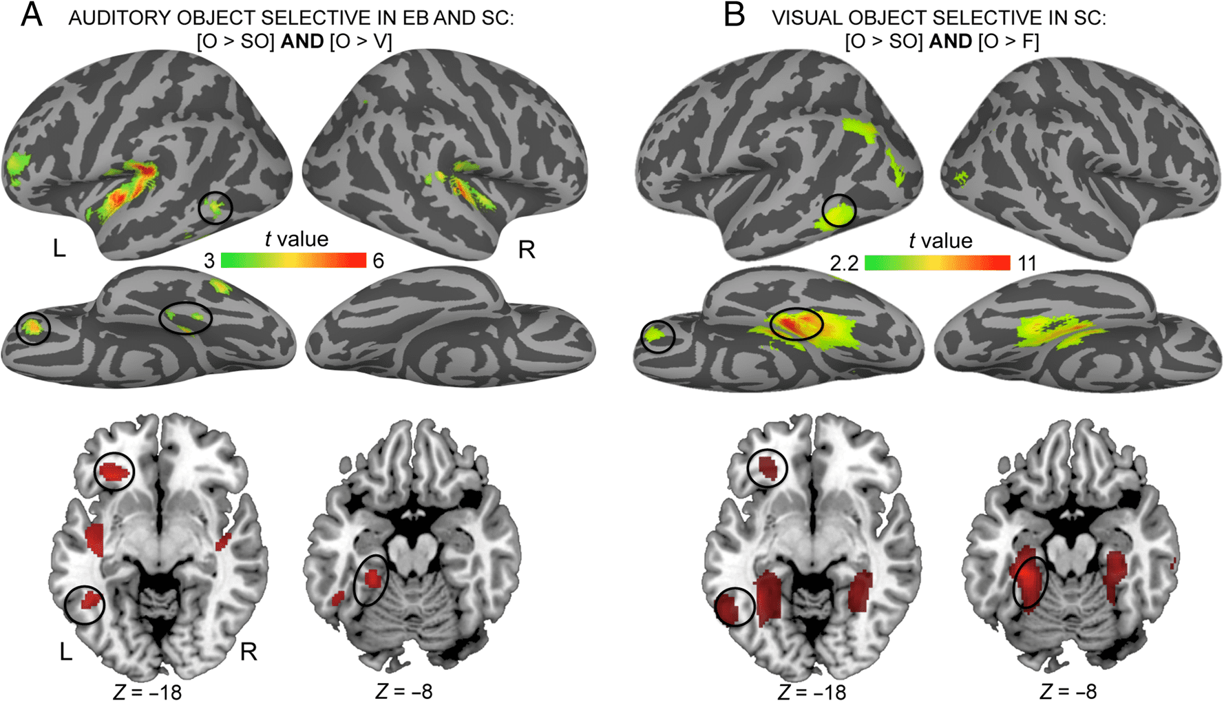 Functional Preference for Object Sounds and image