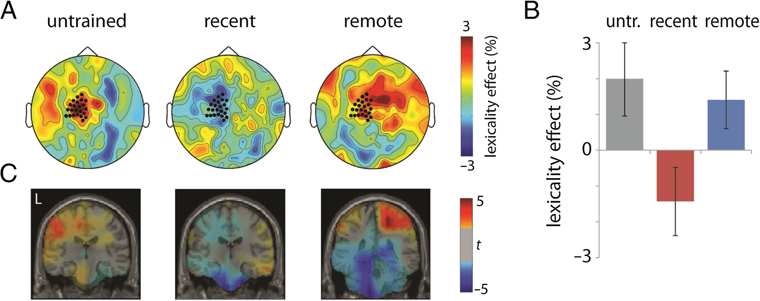 Theta-band Oscillations in the Middle Temporal Gyrus image