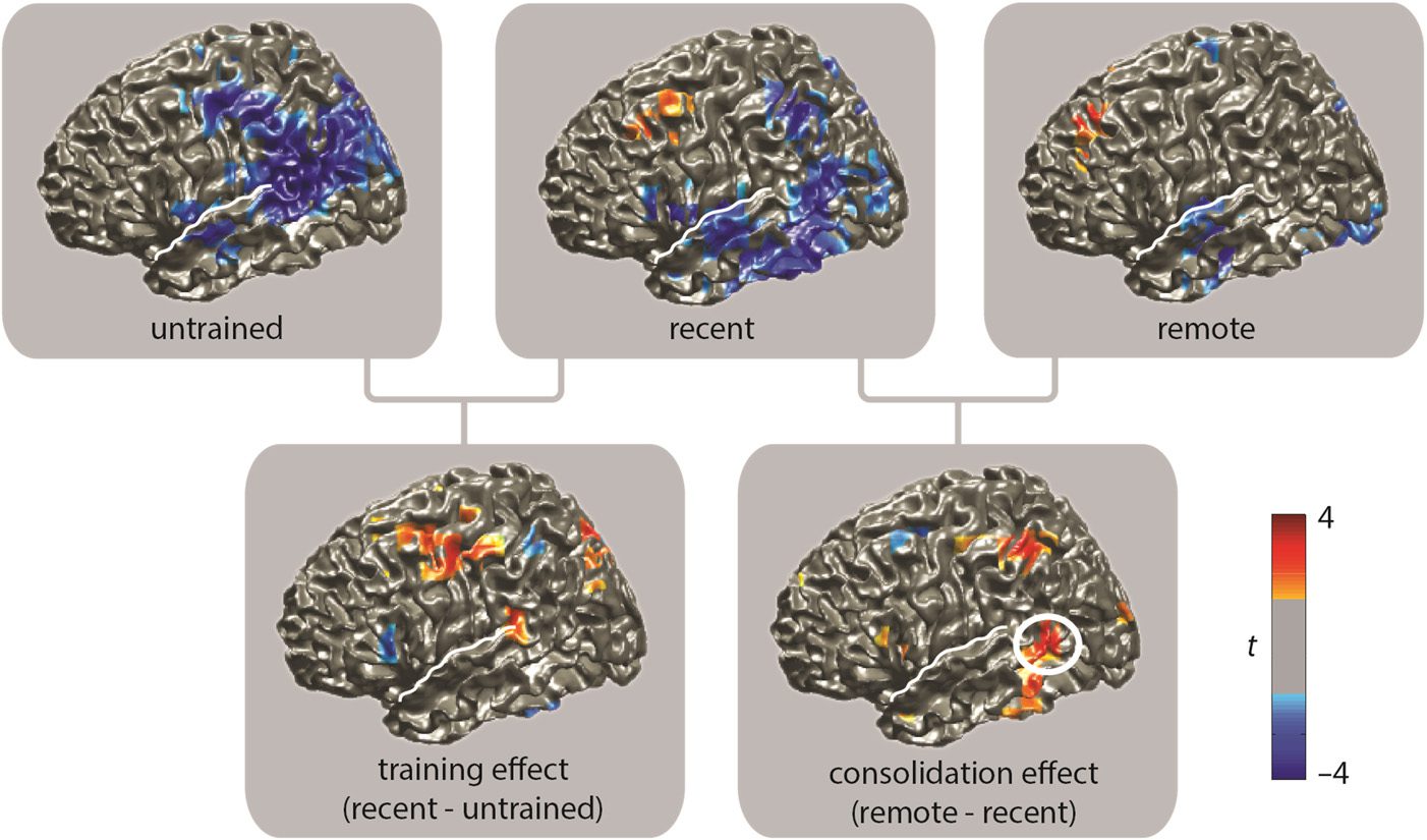 Theta-band Oscillations in the Middle Temporal Gyrus image