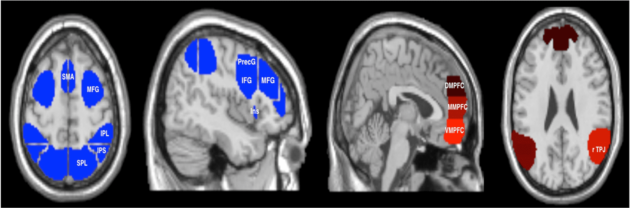 Functional Specificity and Sex Differences in the image