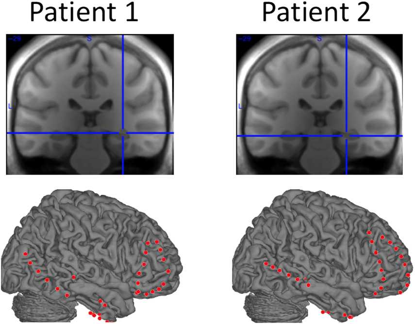 Theta Phase Synchronization between the Human image