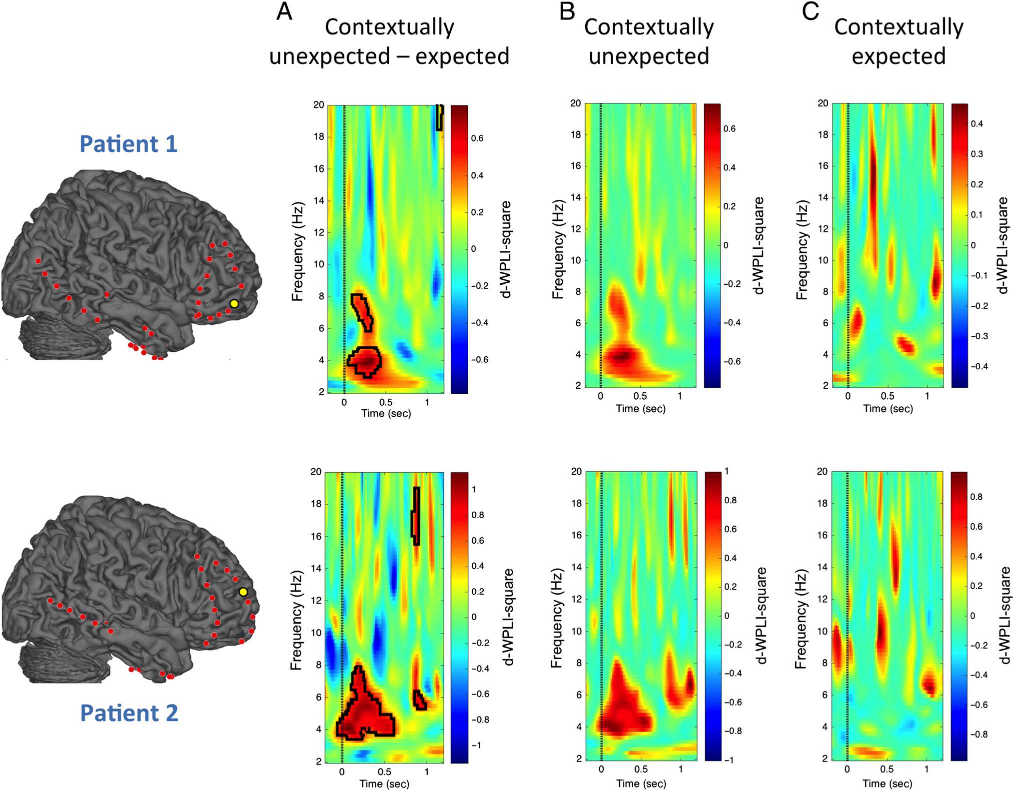 Theta Phase Synchronization between the Human image