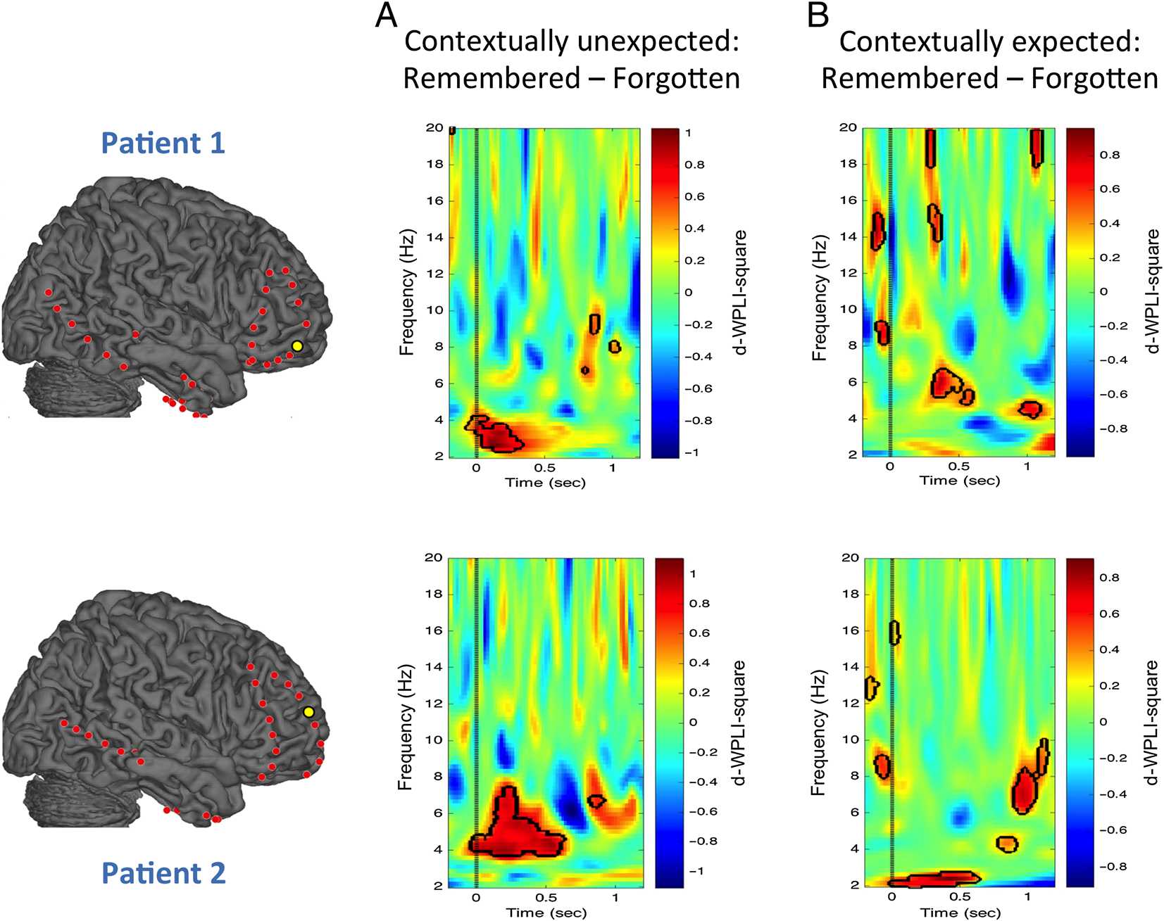 Theta Phase Synchronization between the Human image